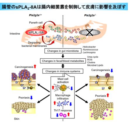 腸胃影響皮膚|腸と皮膚の新たなクロストーク：腸内細菌叢を変えて。